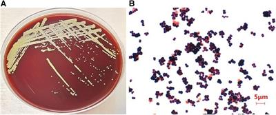 Pathogenetic characterization of a Micrococcus luteus strain isolated from an infant